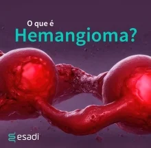 O que é Hemangioma?
