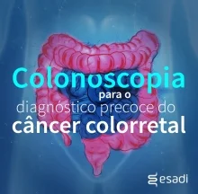 Colonoscopia para o diagnóstico precoce do câncer colorretal