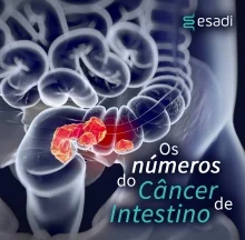 Os números do câncer de intestino