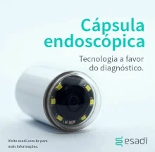 Cápsula endoscópica: tecnologia a favor do diagnóstico