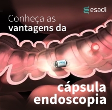 Conheça as vantagens da cápsula endoscópica
