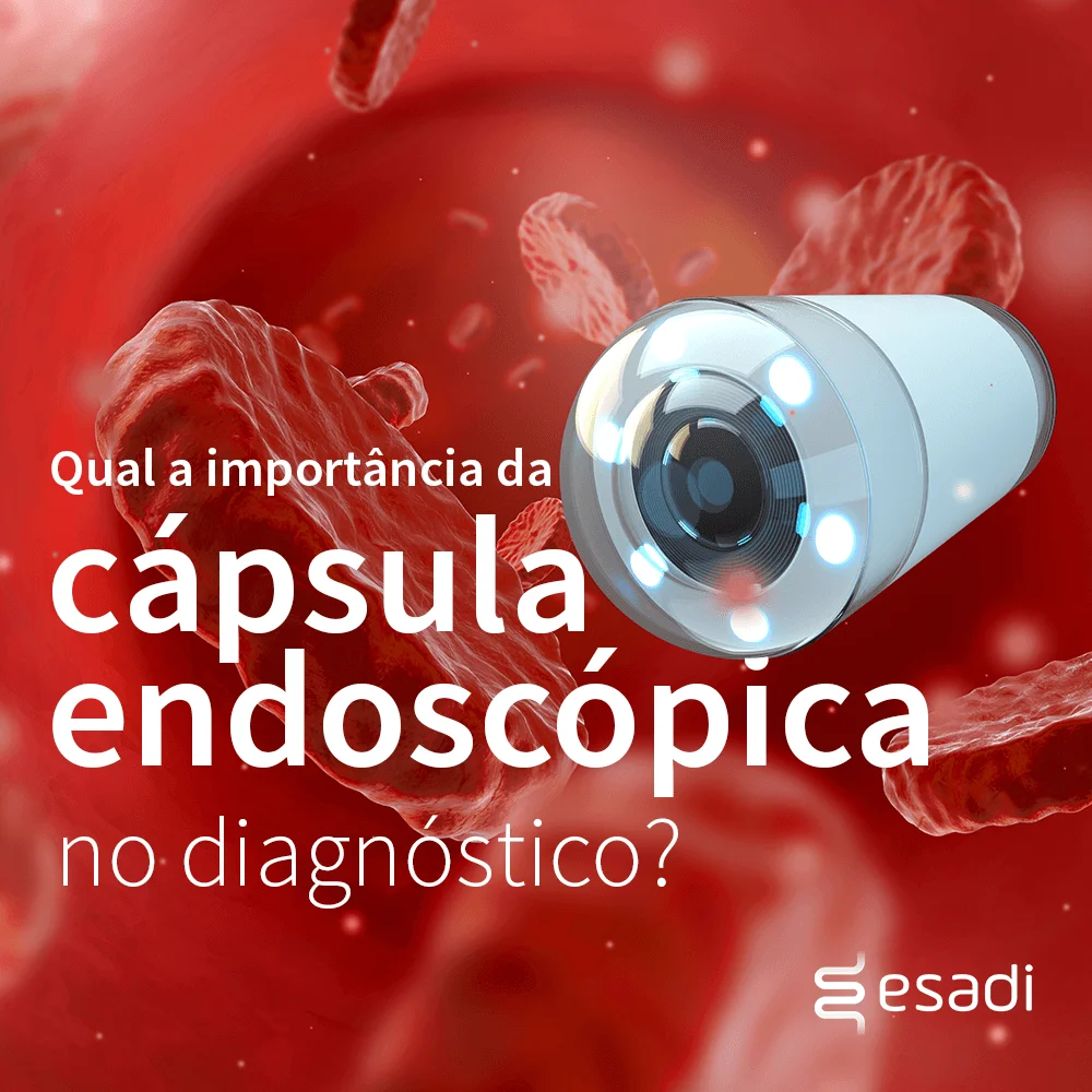 Qual a importância da cápsula endoscópica no dignóstico?