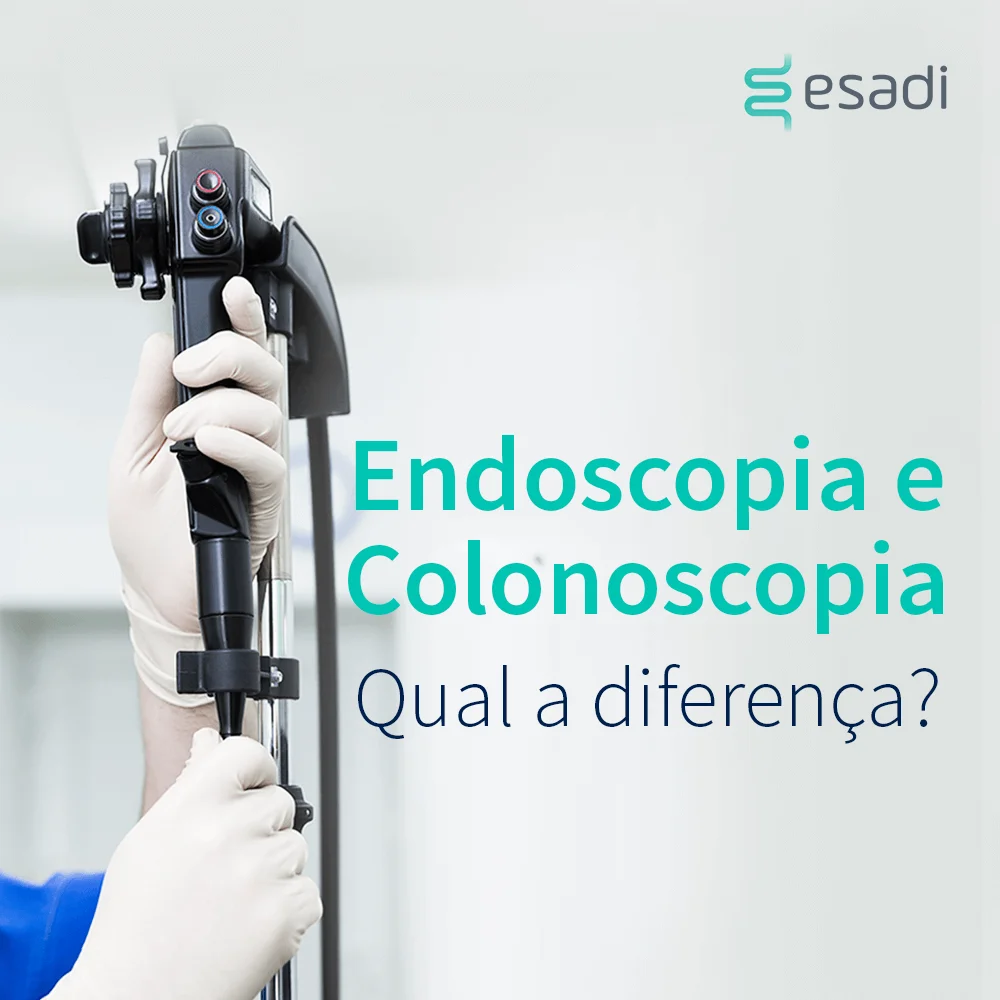 Endoscopia e Colonoscopia - Qual a diferença?