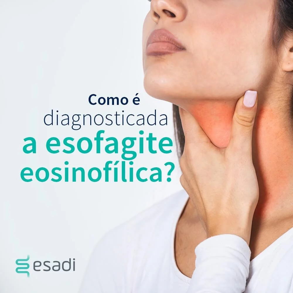Como é diagnosticada a esofagite eosinofílica