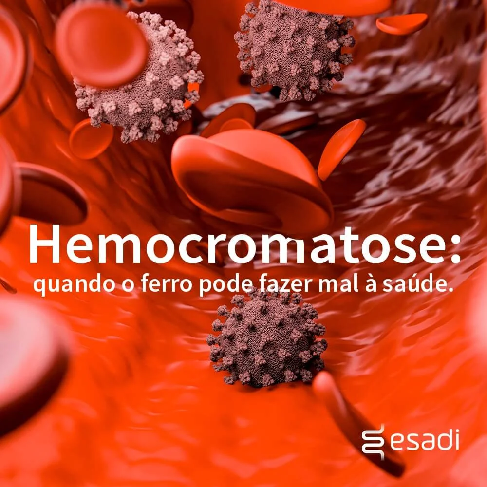 Hemocromatose - quando o ferro pode fazer mal à saúde