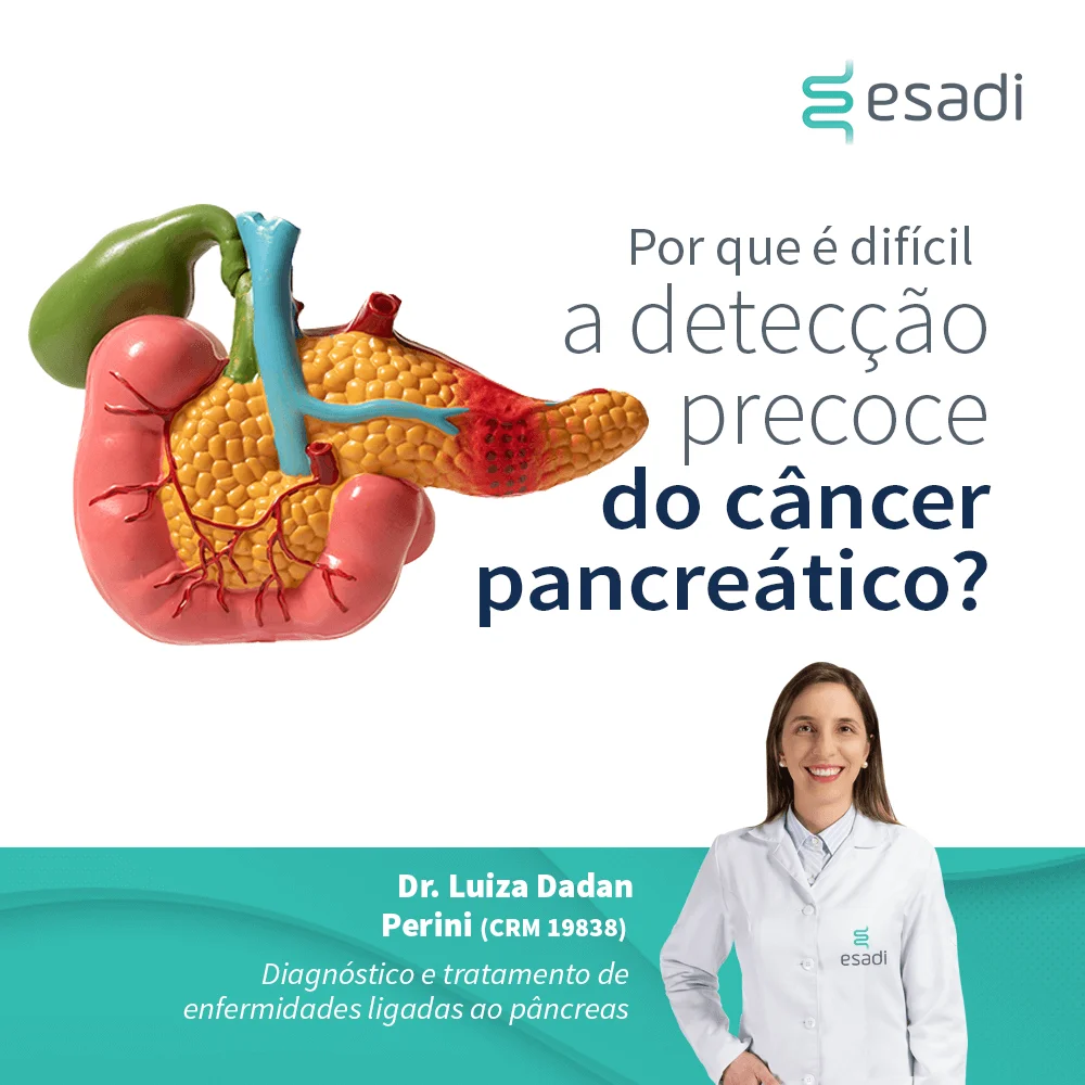 Por que é difícil a detecção precoce do câncer pancreático? 