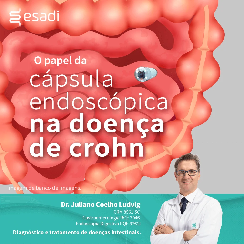 O papel da cápsula endoscópica na doença de Crohn