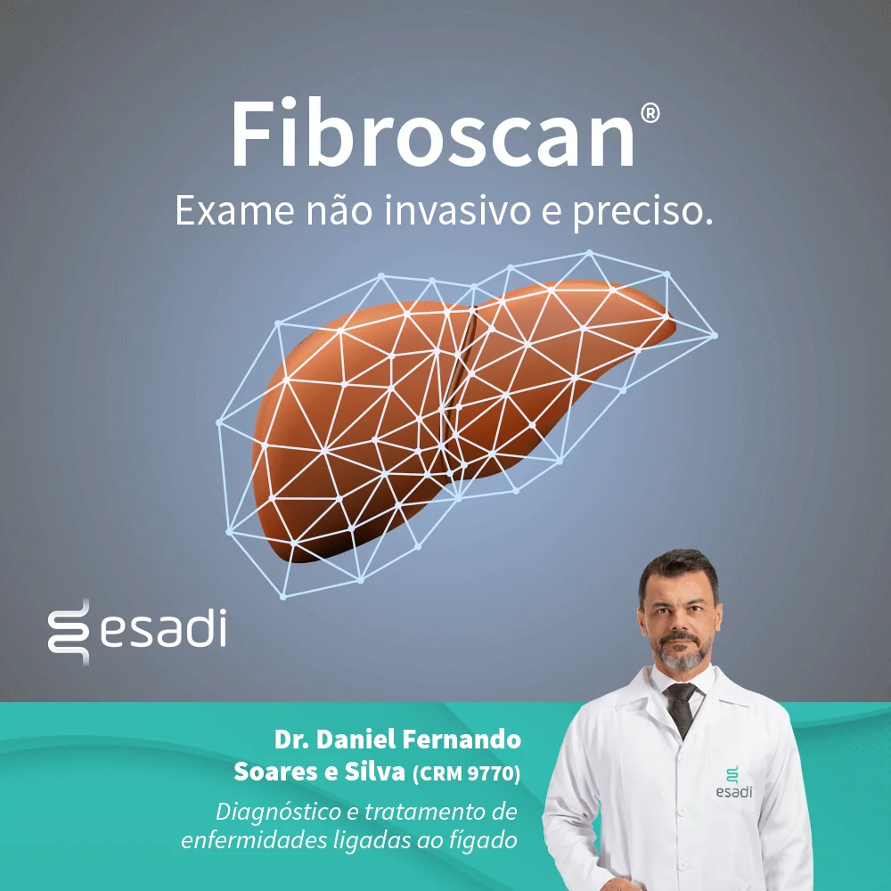 Fribroscan - Exame não invasivo e preciso.