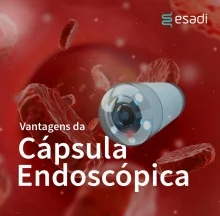 Vantagens da cápsula endoscópica