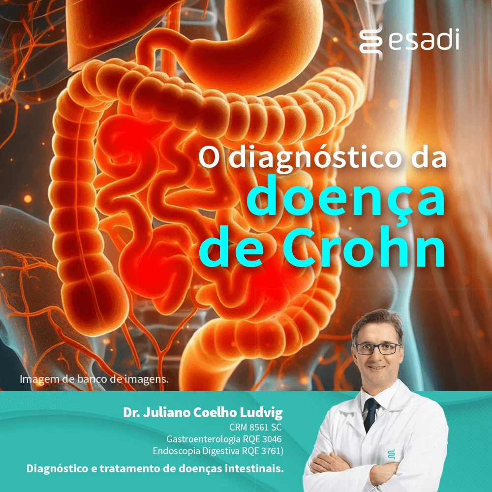 O diagnóstico da doença de Crohn