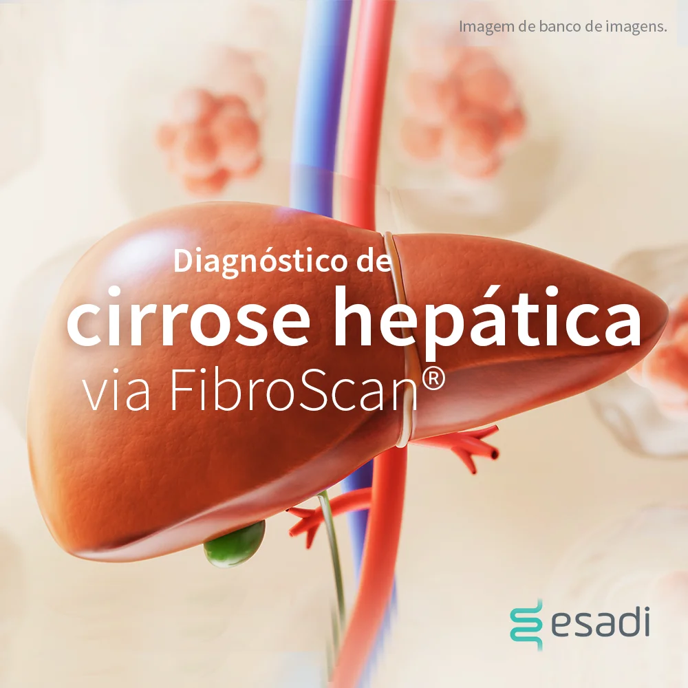 Diagnóstico de cirrose hepática via Fibroscan