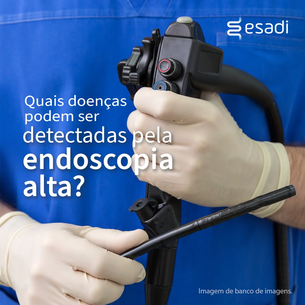 Quais doenças podem ser detectadas pela endoscopia alta? 