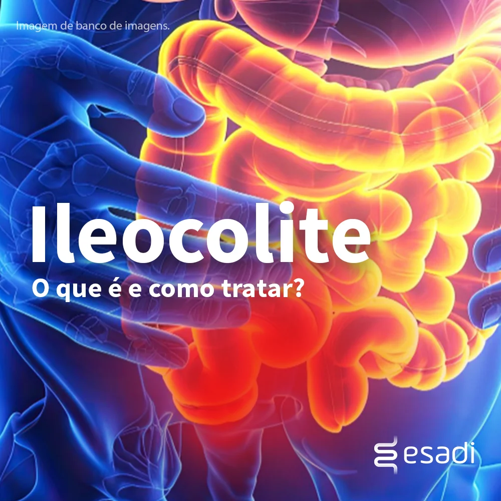 Ileocolite - O que é e como tratar? 