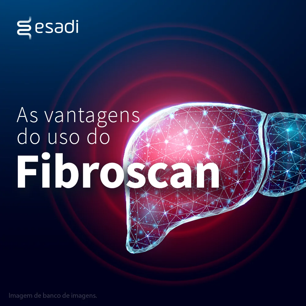 As vantagens do uso de Fibroscan