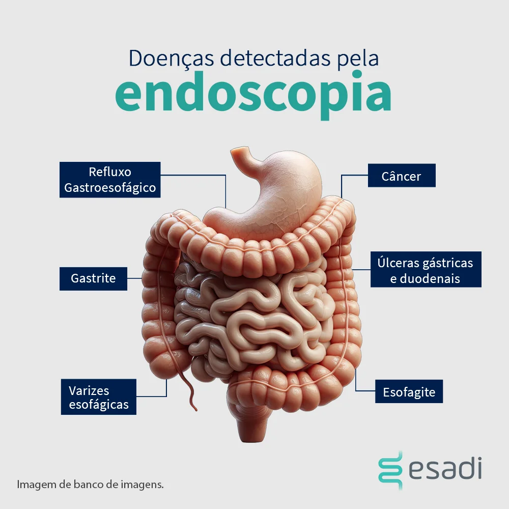 Doenças detectadas pela endoscopia