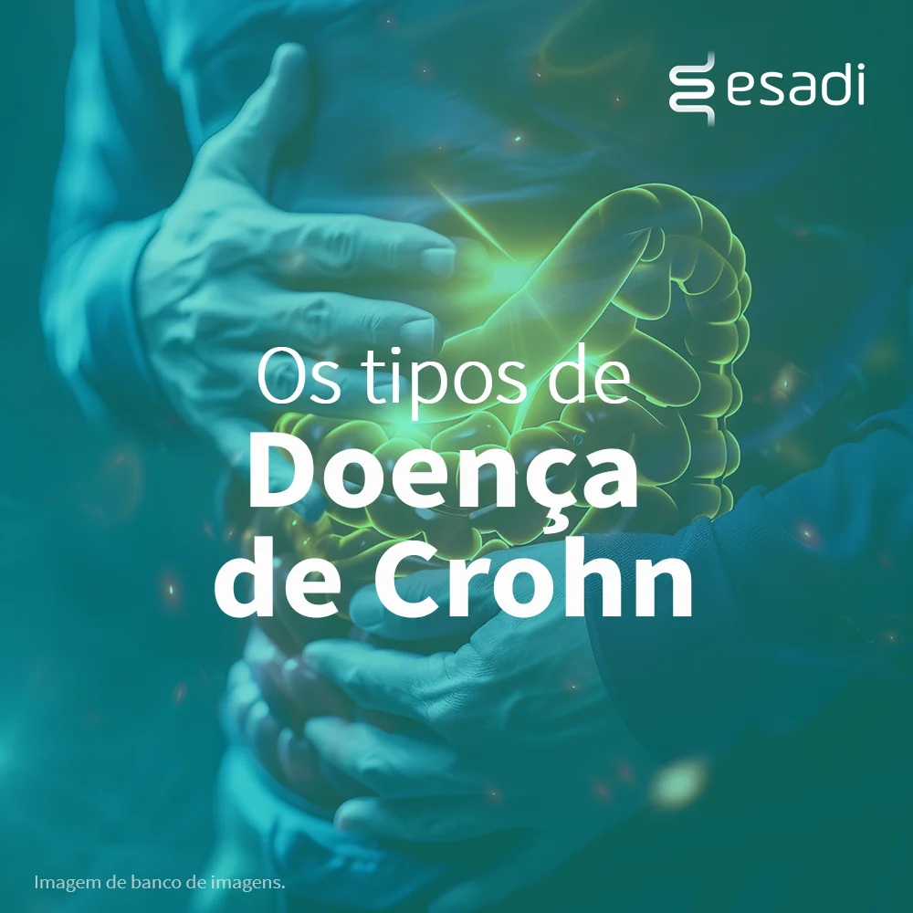 Os tipos de Doença de Crohn