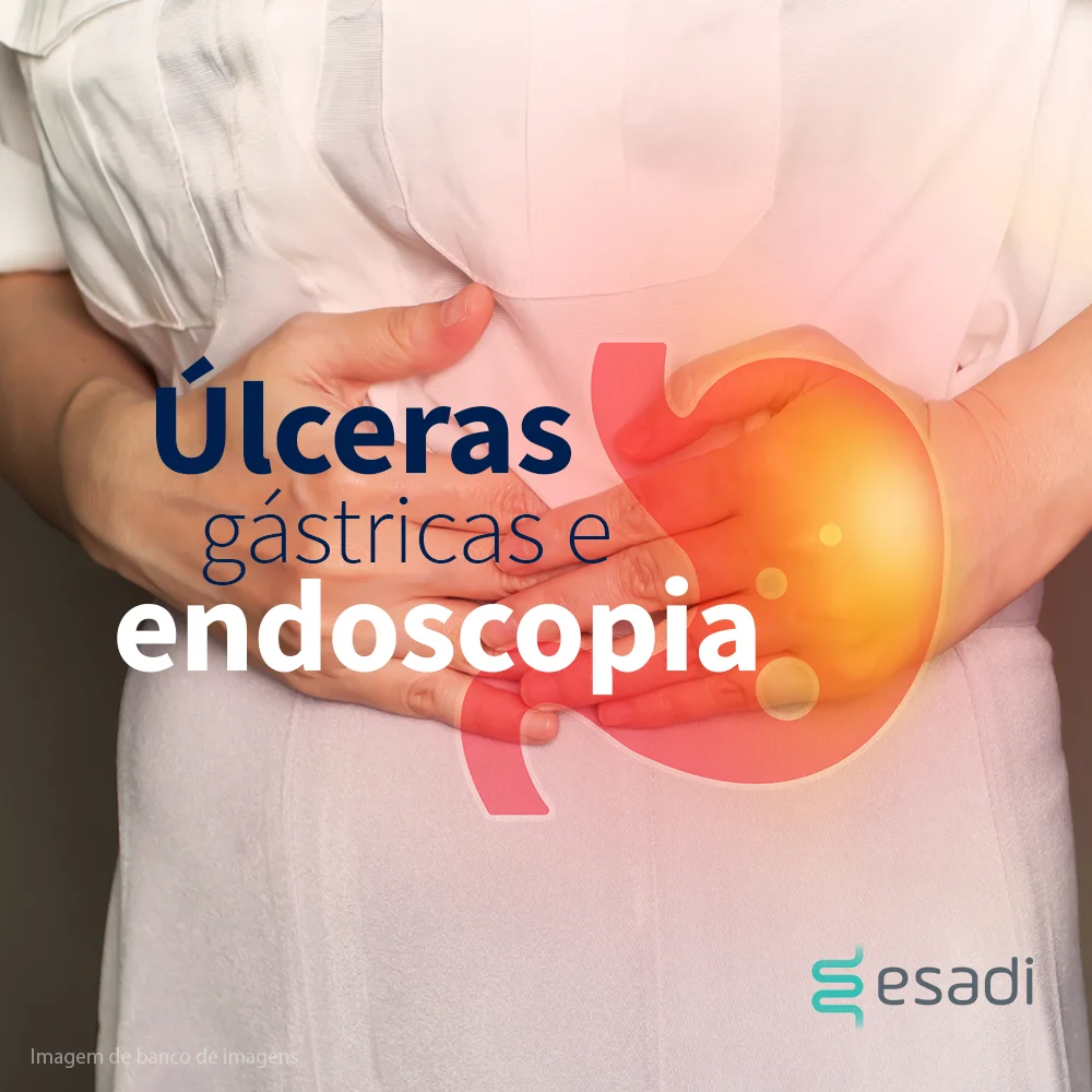 Úlceras gástricas e endoscopia