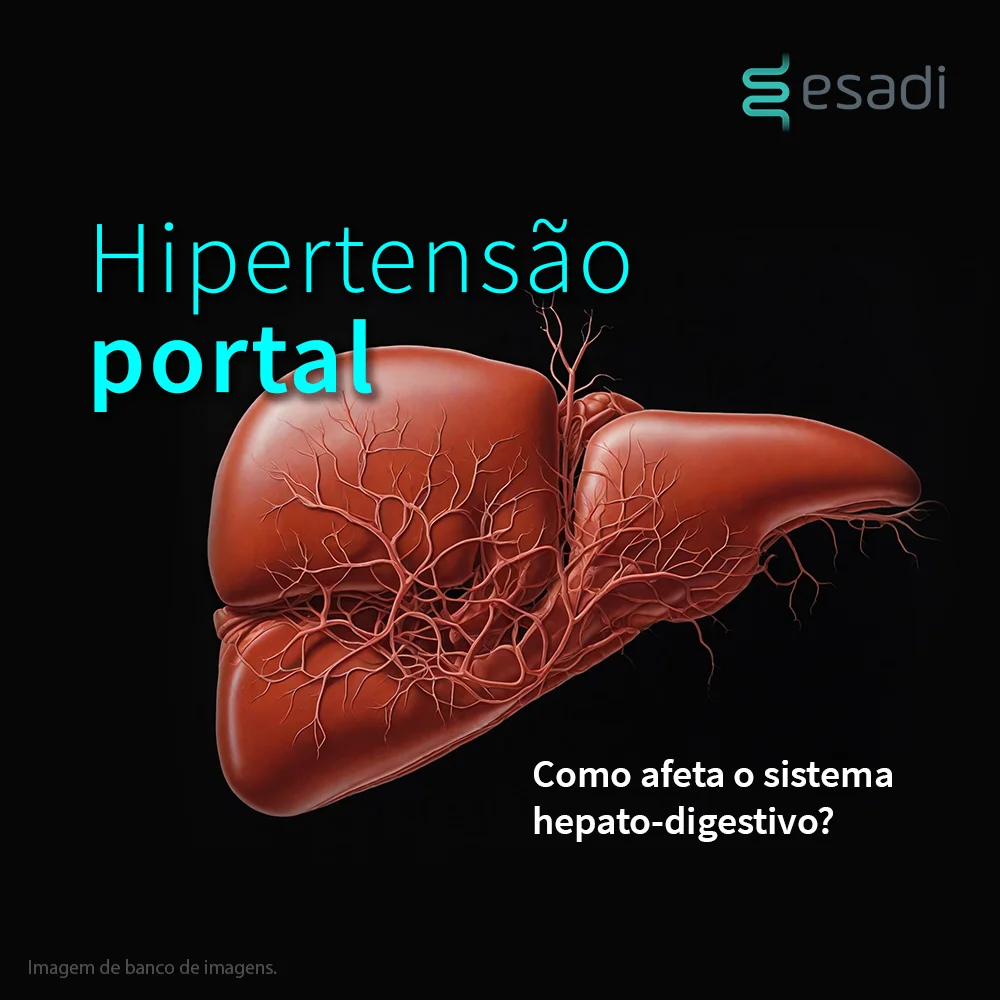 Hipertensão Portal - Como afeta o sistema hepato-digestivo?