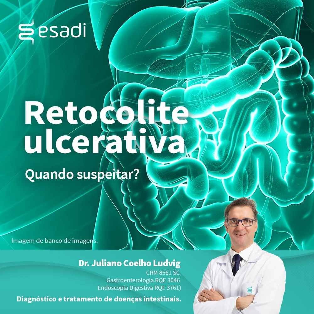 Retocolite ulcerativa - Quando suspeitar? 