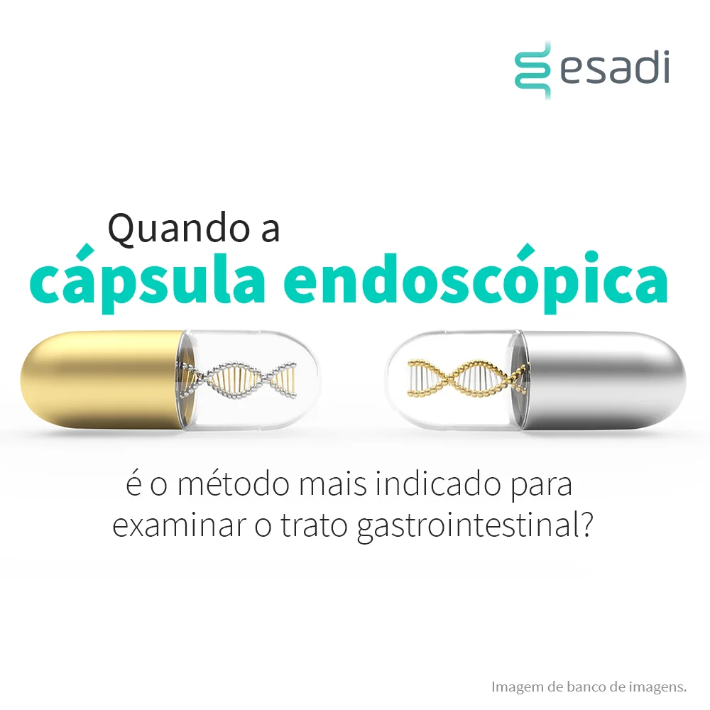 Quando a cápsula endoscópica é o método mais indicado para examinar o trato gastrointestinal? 