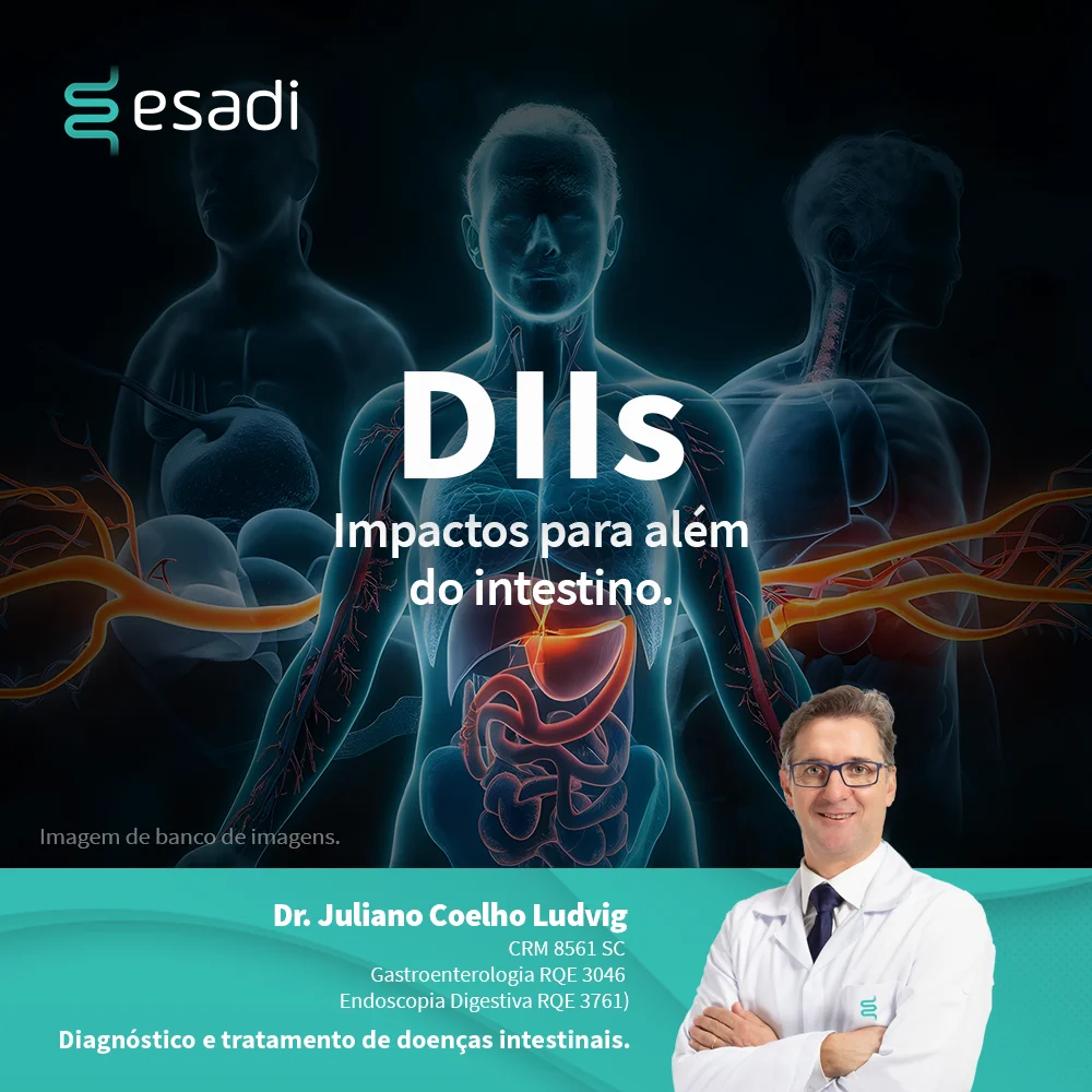 DIIs - Impactos para além do intestino