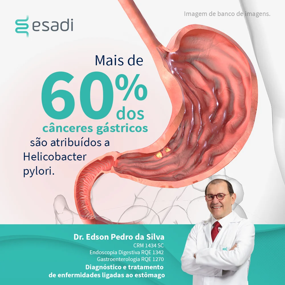 Mais de 60% dos cânceres gástricos sãos atribuídos a Helicobacter pylori 