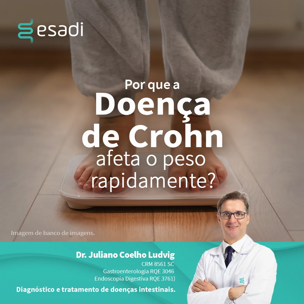 Por que a doença de Crohn afeta o peso rapidamente?