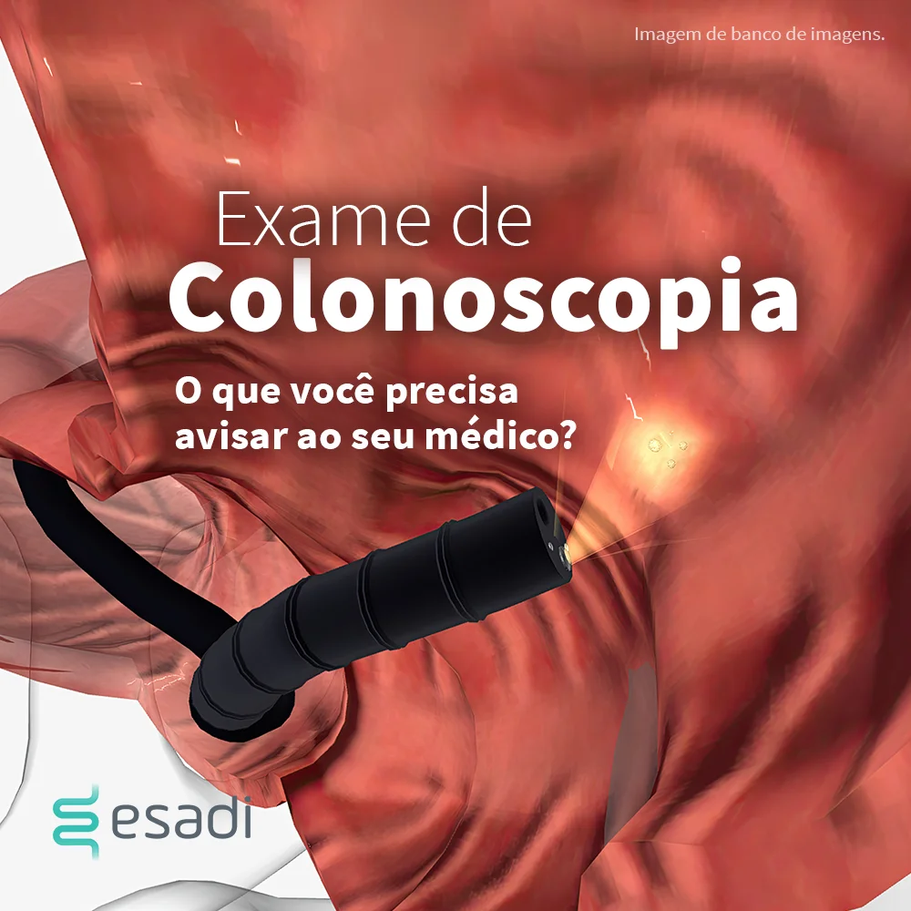 Exame de colonoscopia - O que você precisa avisar para o seu médico? 