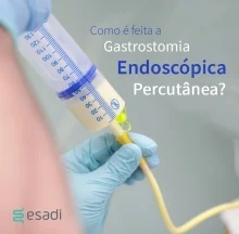 Como é feita a Gastrostomia Endoscópica Percutânea