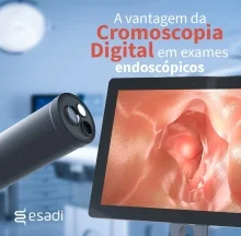 A vantagem da Cromoscopia Digital em exames endoscópicos