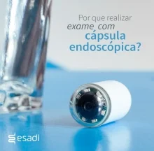 Por que realizar exame com cápsula endoscópica?