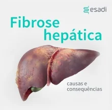 Fibrose hepática: Causas e consequências